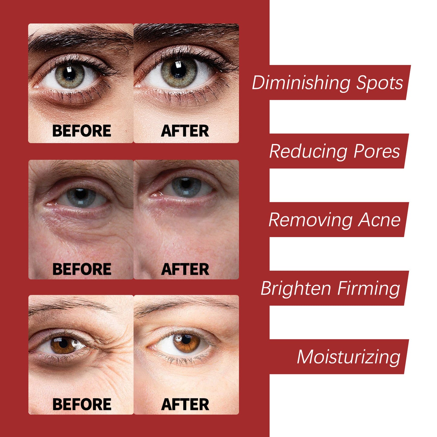 Lightening Fine Lines Dark Circles Moisturizing Nourishing Anti-Aging Face Cream