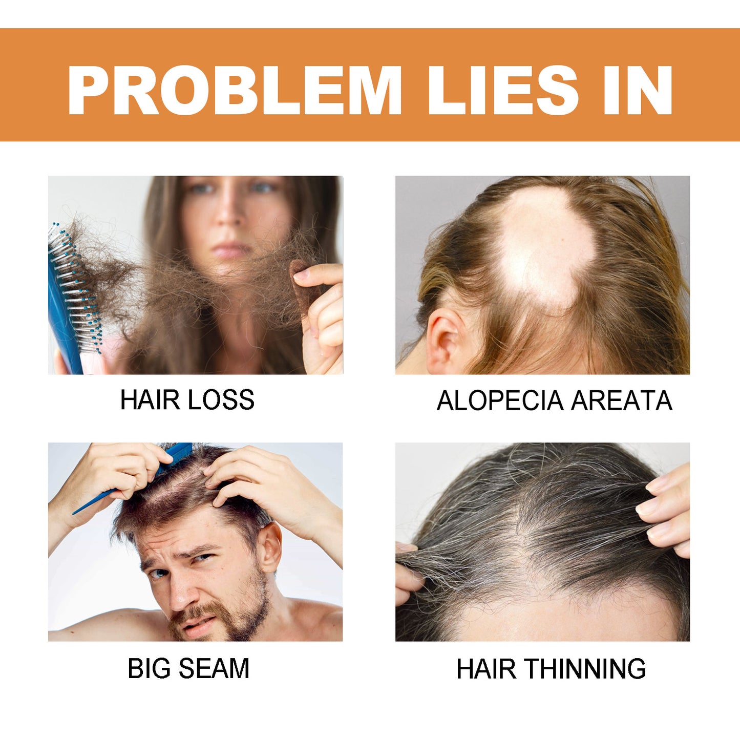 Strong Repair Anti-Hair Loss Scalp Care Solution