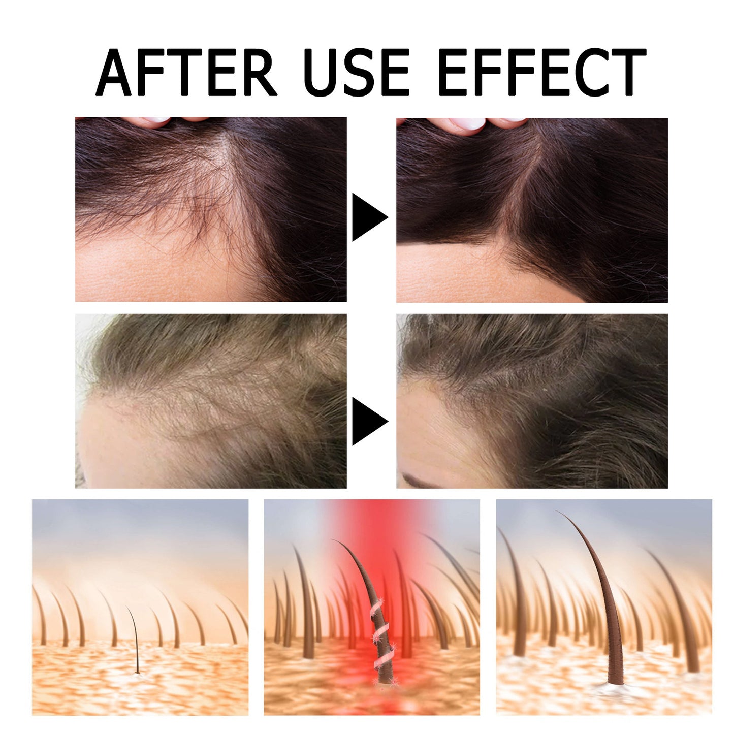Strong Repair Anti-Hair Loss Scalp Care Solution